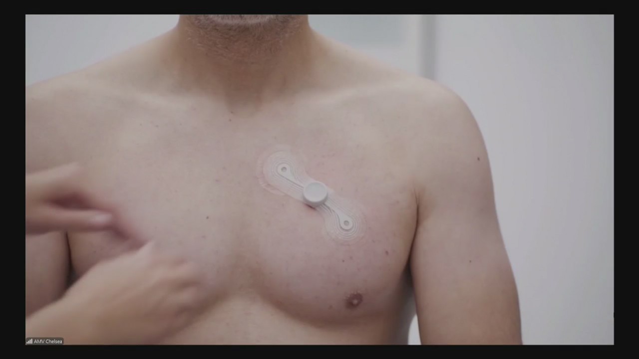 AFIB (1/28/2025) – Eyewitness News (WEHT/WTVW)