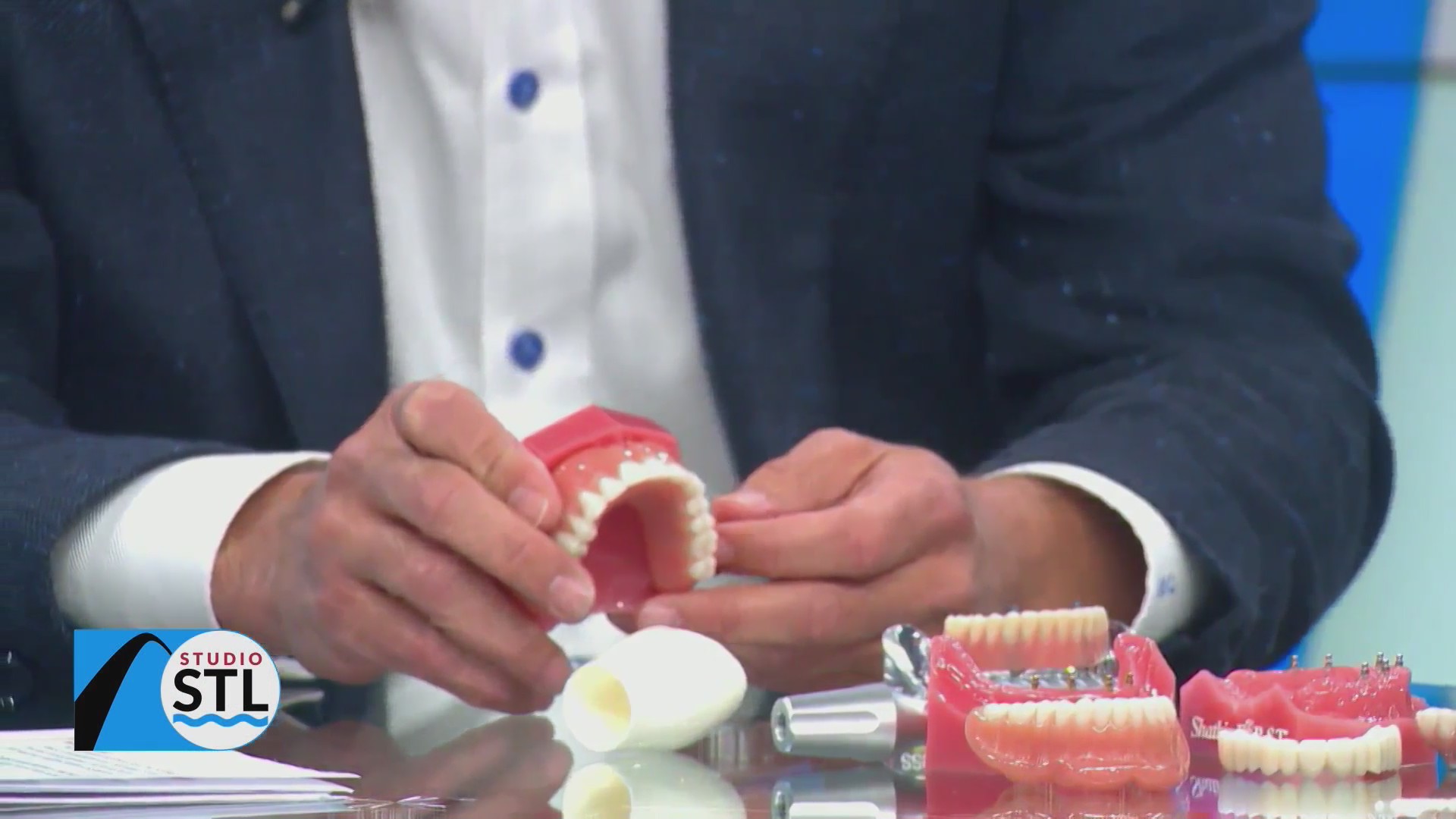 Dental implants that look real and act like original teeth at Troy ...