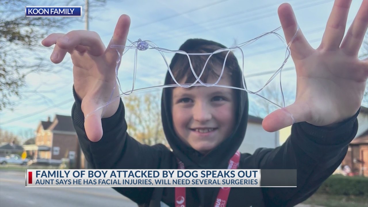 Family of boy attacked by dog speaks out – NBC4 WCMH-TV