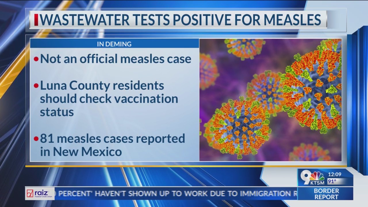 Wastewater in Deming tests positive for measles – KTSM 9 News
