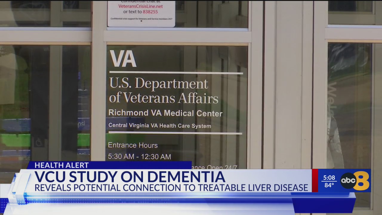 Wric Mu Ac In VCU researchers find 13% of dementia patients may have undiagnosed ...