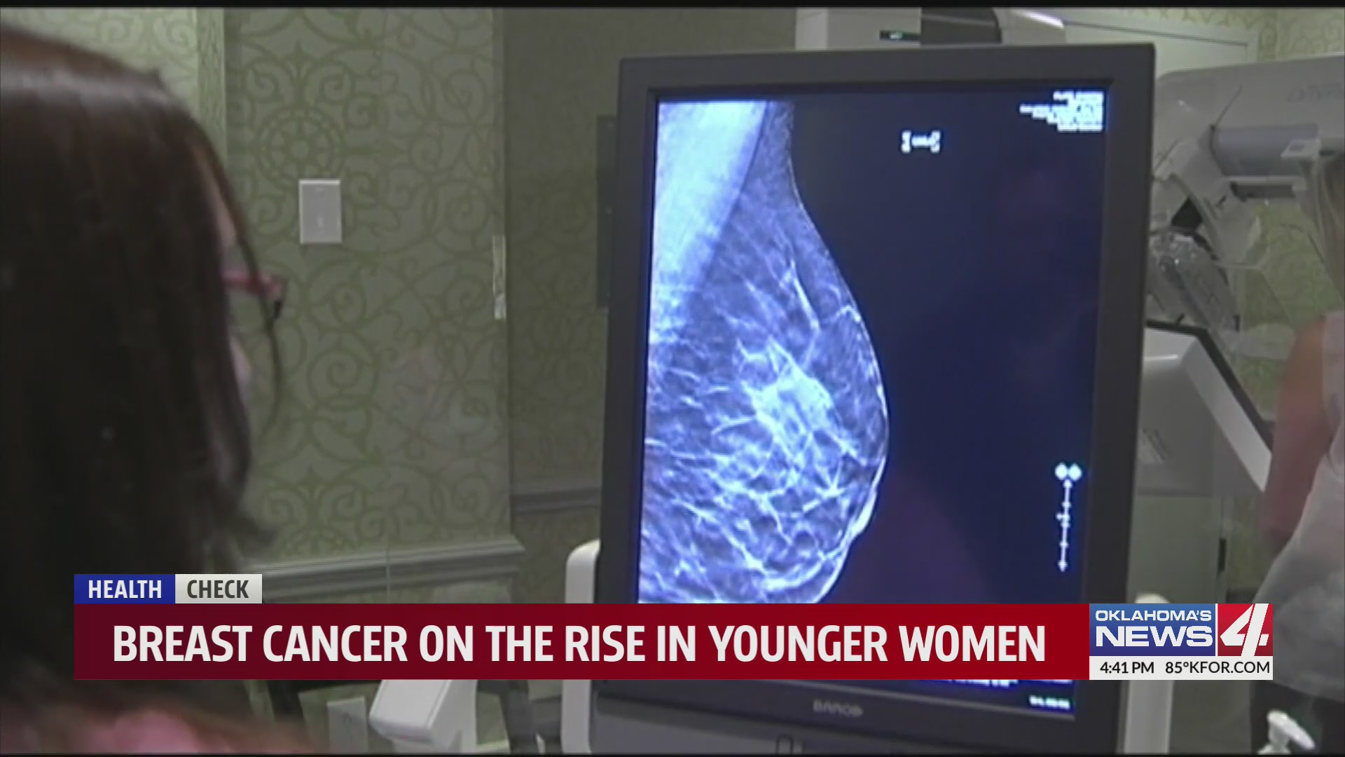 Breast cancer on the rise in younger women – KFOR.com Oklahoma City
