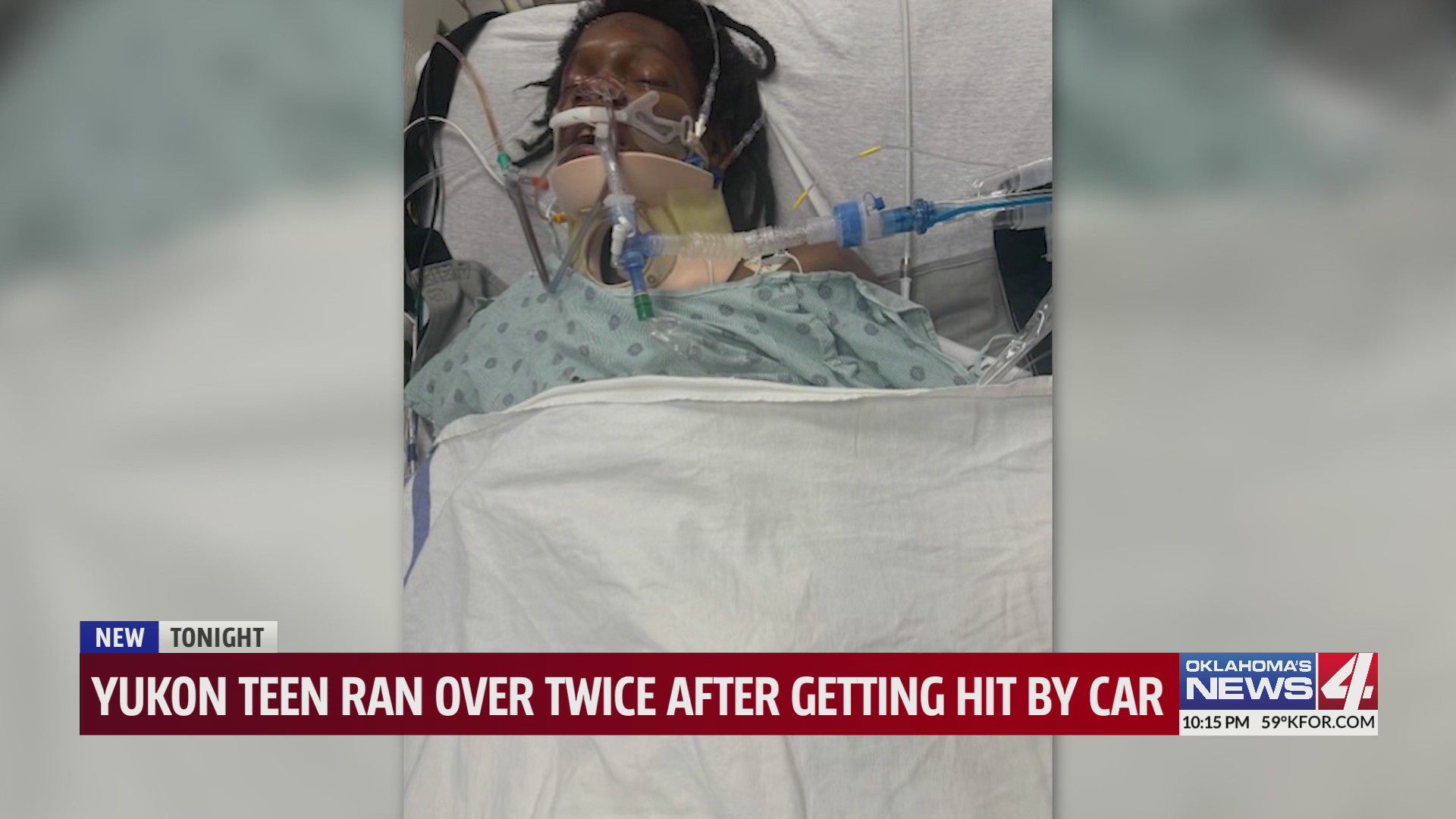 Yukon teen ran over twice after getting his by car – KFOR.com Oklahoma City