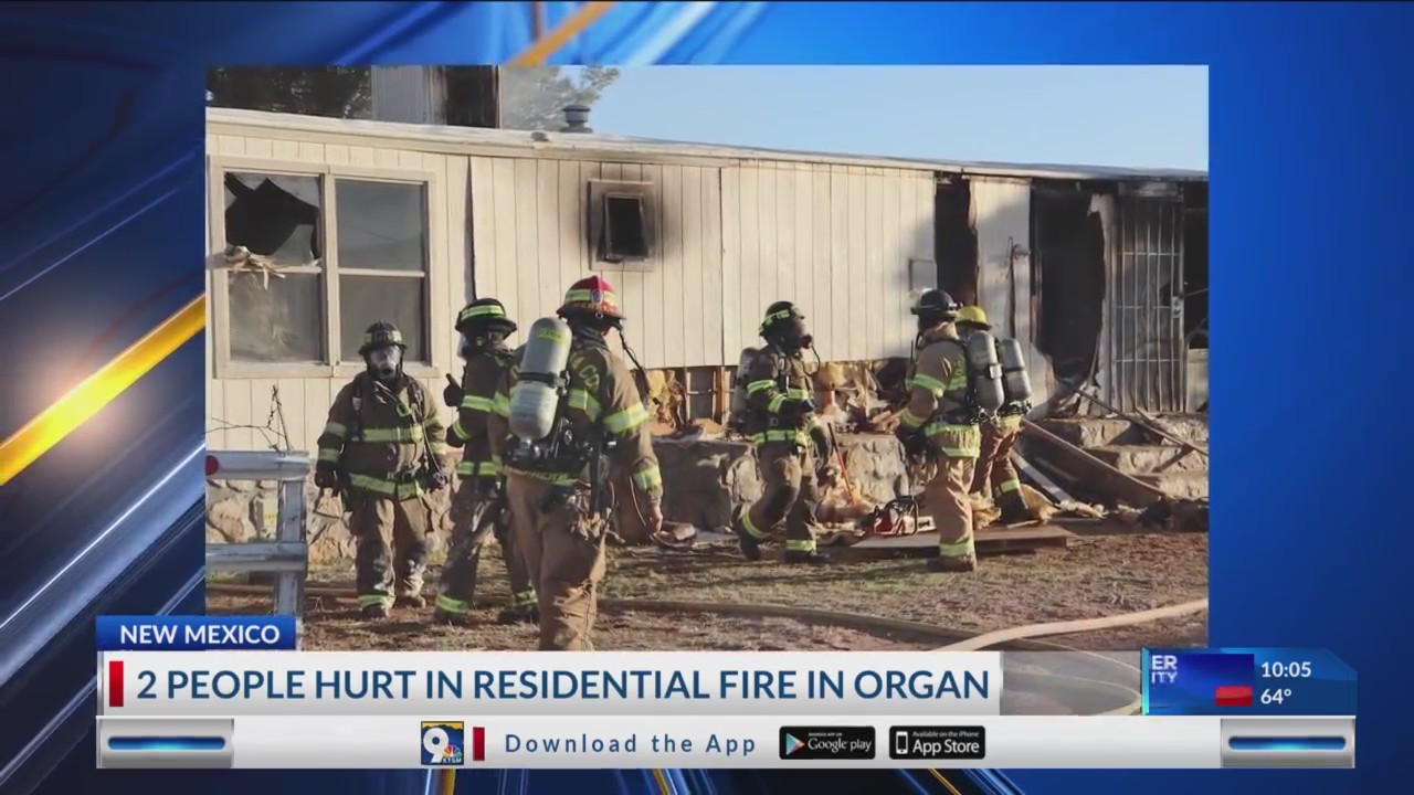 2 hurt in fire in rural Doña Ana County – KTSM 9 News