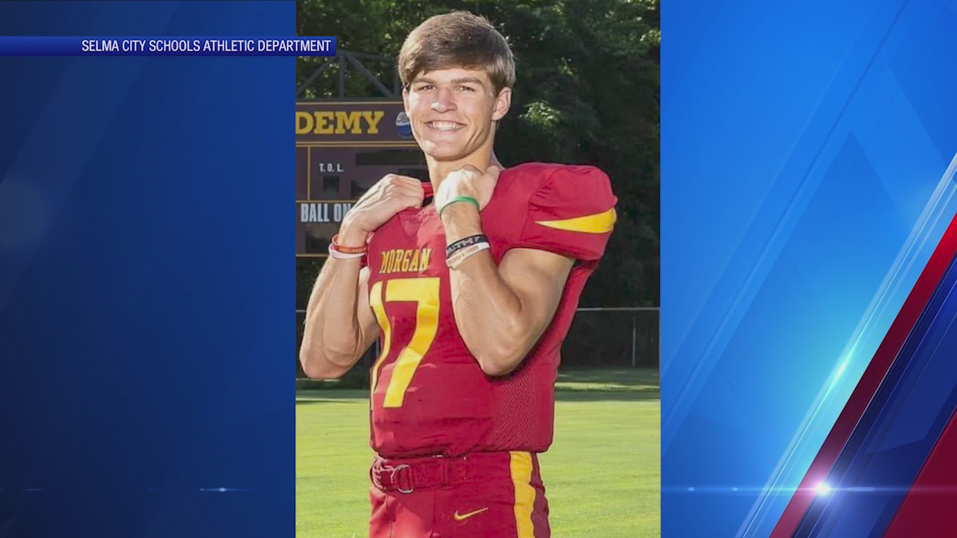Alabama high school player dies after brain injury during game – FOX 2