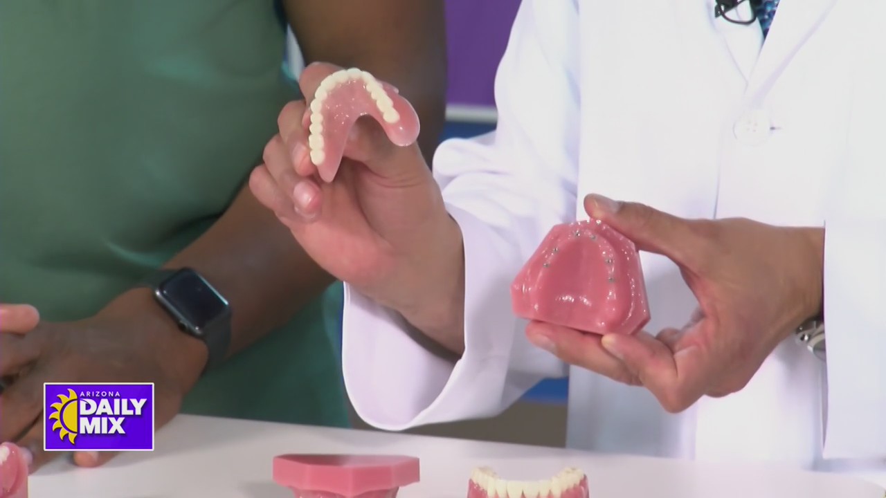 Mini X Teeth Replacing a full set of teeth with mini dental implants – CW7 Arizona