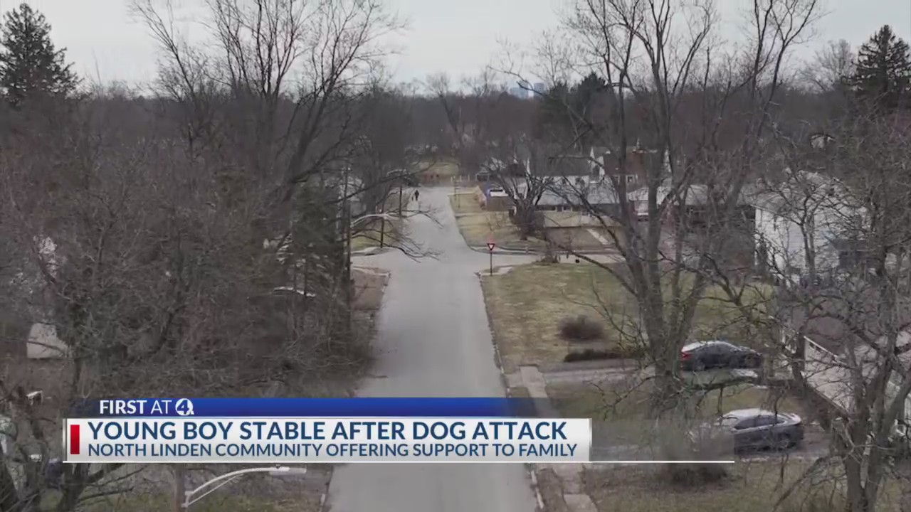 Young boy stable after dog attack in North Liden – NBC4 WCMH-TV