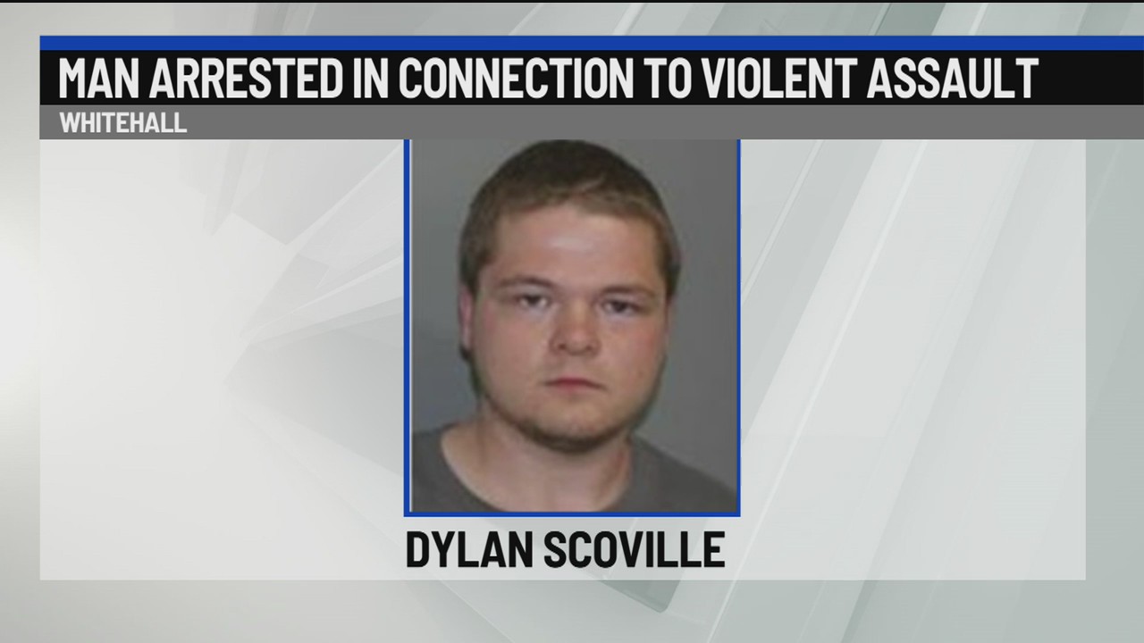 Man arrested in connection to violent assault – NEWS10 ABC