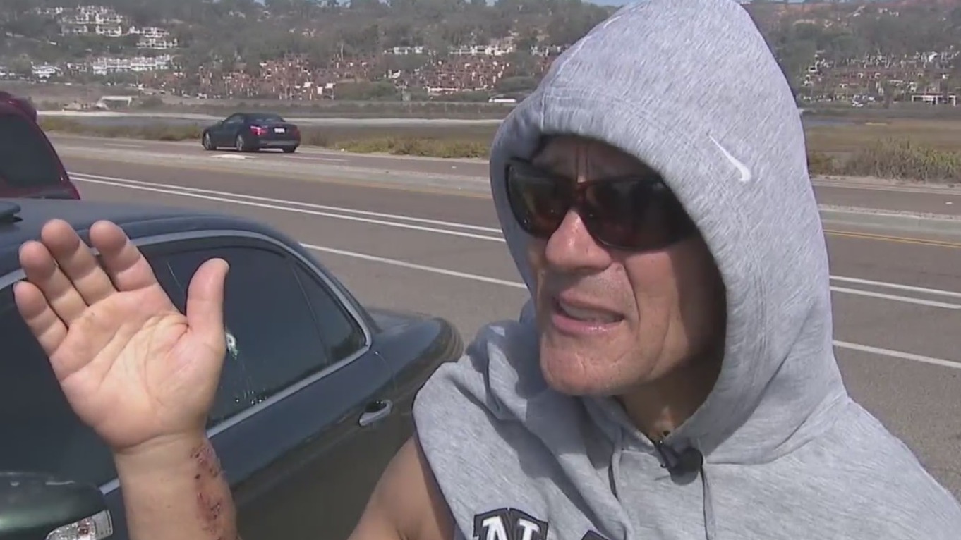 Man shot near Palomar Mountain speaks out – FOX 5 San Diego & KUSI News