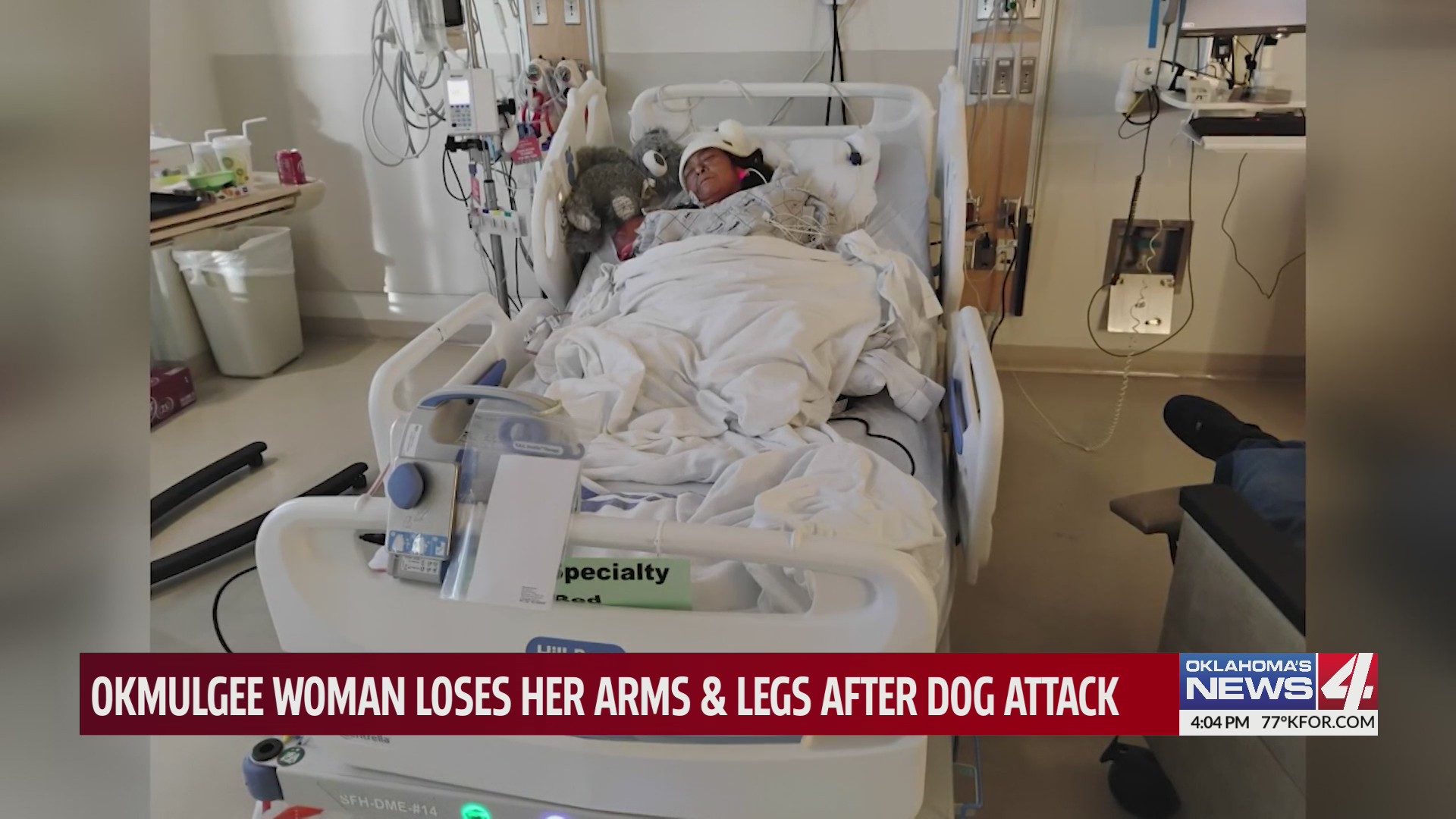 Okmulgee woman loses her arms & legs after dog attack – KFOR.com ...