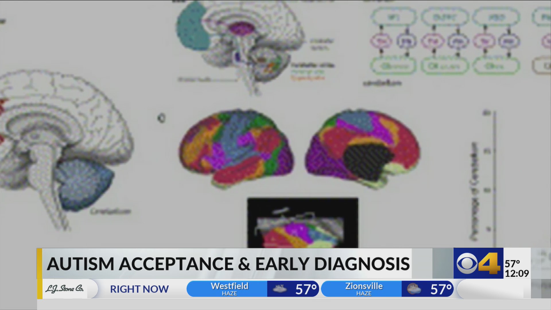 Indiana autism evaluation hub helps diagnose thousands of kids – Fox 59