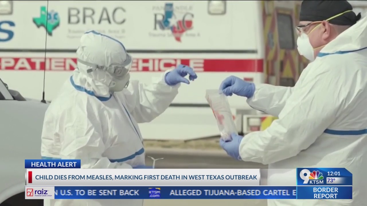 Child dies from measles, marking first death in West Texas outbreak ...