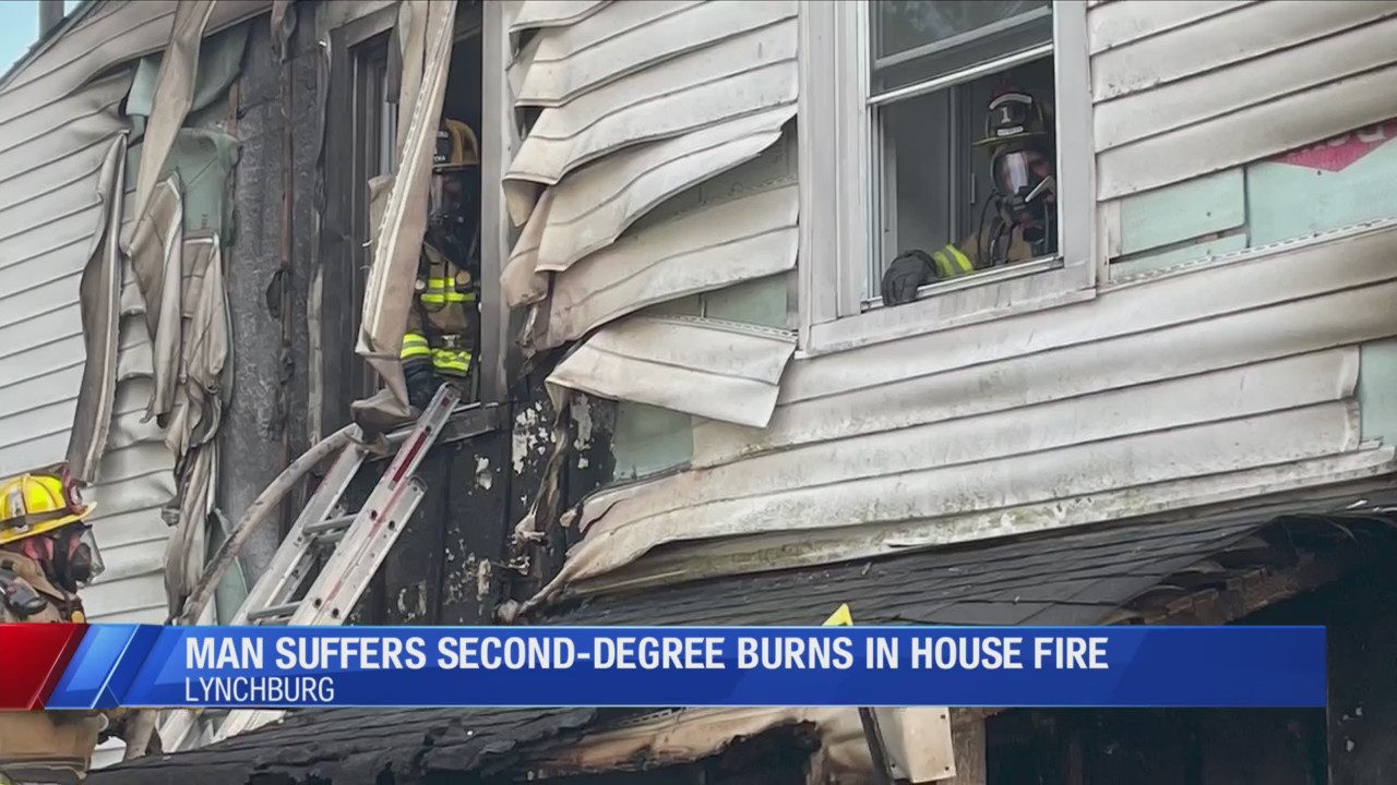 Man suffers second-degree burns in house fire on Bedford Ave in ...