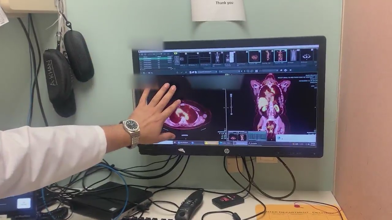 New AI tool helps diagnose patients at Ellis Medicine – NEWS10 ABC
