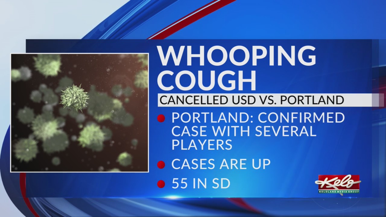 What you need to know about whooping cough – KELOLAND.com