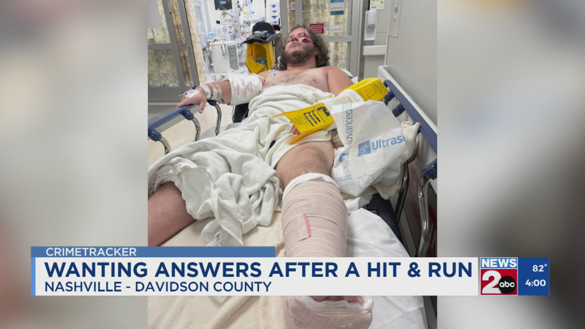 Family wants answers after man injured in Nashville hit-and-run – WKRN ...